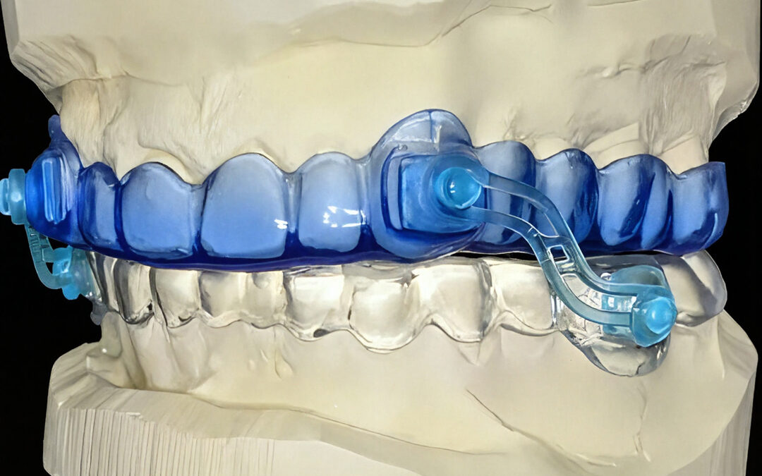 Anti-Schnarch-Schiene